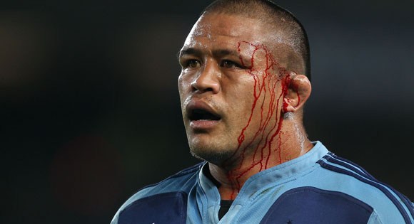 Blues captain Keven Mealamu with blood. Blues v Waratahs, Investec Super Rugby, Eden Park, Auckland, New Zealand. Saturday 16 April 2011 . Photo: Simon Watts / photosport.co.nz